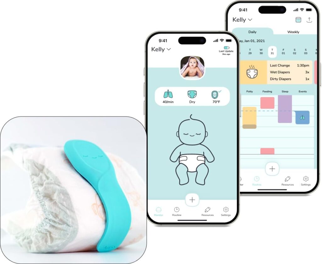 Aurio Smart Baby Monitor – Tracks Breathing Rate, Sleep, Diaper Wetness, Temperature, Real-Time Alerts with Patented Technology